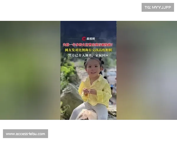 高菁遥骨折康复过程公开 网友称其为坚强钢铁女孩展现不屈精神 高菁遥骨折康复过程公开 网友称其为坚强钢铁女孩展现不屈精神